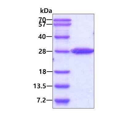 SDS-Page: Recombinant Human STARD5 His Protein [NBP2-22829] - 3ug by SDS-PAGE under reducing condition and visualized by coomassie blue stain.